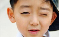 <b>孩子频繁眨眼怎么回事？是抽动症吗？</b>
